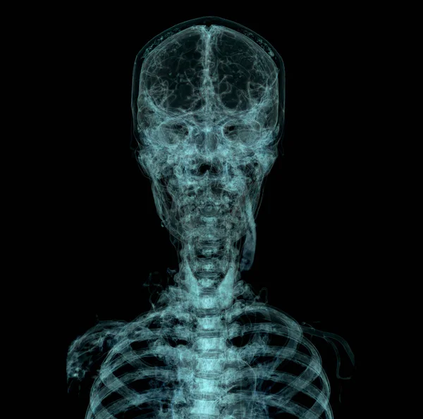 Crânio Humano Cérebro Por Tac Visualização Raios Dentro Crânio Renderização — Fotografia de Stock