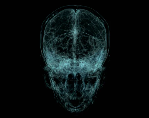 人类骷髅 Ct扫描大脑 颅骨内部的X射线可视化 3D说明性渲染 — 图库照片