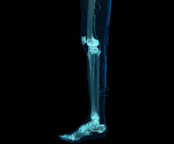 Rendering Delle Estremità Inferiori Delle Gambe Isolate Sfondo Nero — Foto Stock