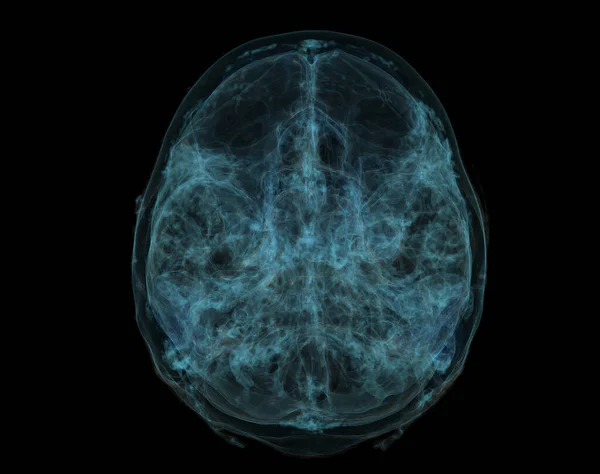 人类骷髅 Ct扫描大脑 颅骨内部的X射线可视化 3D说明性渲染 — 图库照片