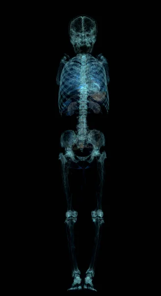 CT scan of whole human body.