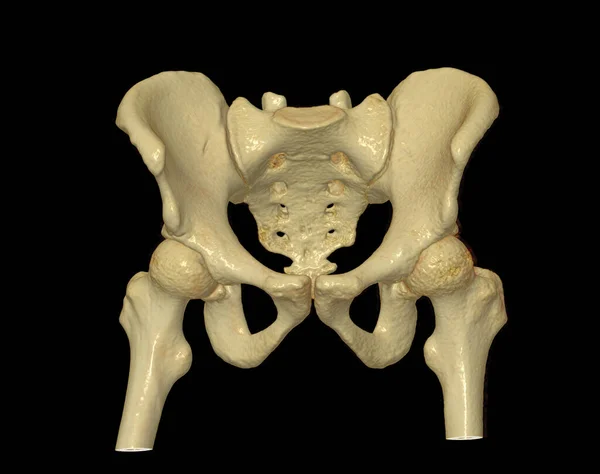 Сканування Кісток Пеліпа Кульшового Суглоба Рендерингу Діагностики Переломів Пелікальної Кістки — стокове фото