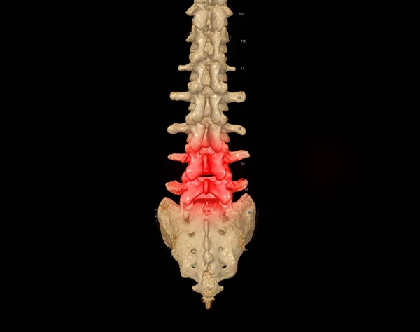 Bel Omurgasının Tomografisi Profil Insan Omurgasını Gösteriyor Kas Iskeleti Sistemi — Stok fotoğraf