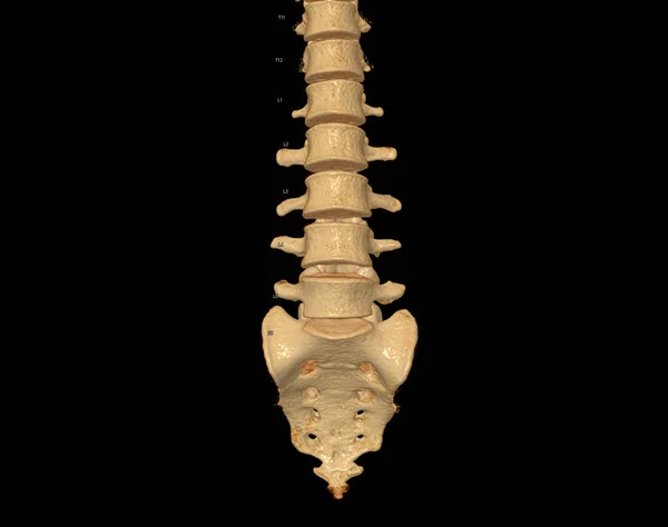 CT scan of Lumbar spine 3D rendering showing Profile Human Spine. Musculoskeletal System Human Body. Structure Spine. Studying Problem Disease and Treatment Methods. isolated on black background.