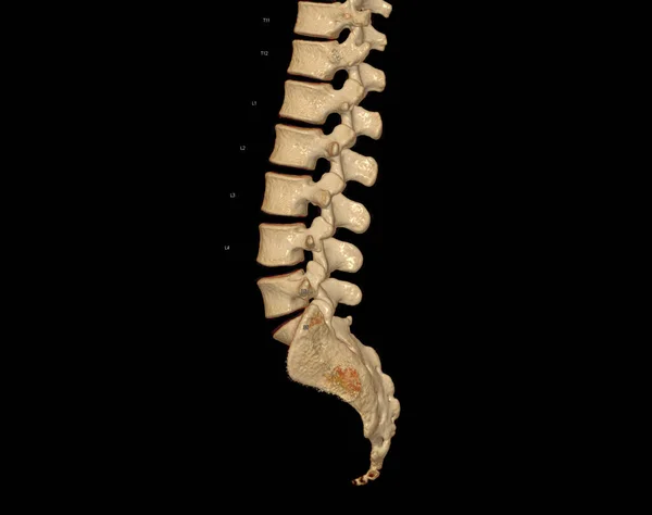 CT scan of Lumbar spine 3D rendering showing Profile Human Spine. Musculoskeletal System Human Body. Structure Spine. Studying Problem Disease and Treatment Methods. isolated on black background.