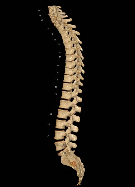 CT scan of Whole spine 3D rendering showing Profile Human Spine. Musculoskeletal System Human Body. Structure Spine. Studying Problem Disease and Treatment Methods. isolated on black background.