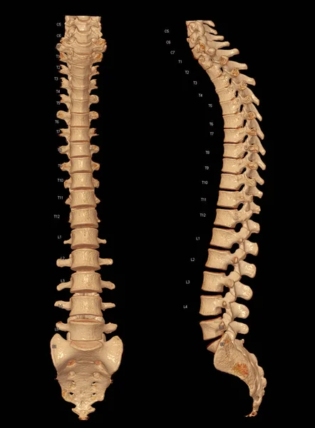 CT scan of Whole spine 3D rendering showing Profile Human Spine. Musculoskeletal System Human Body. Structure Spine. Studying Problem Disease and Treatment Methods. isolated on black background.