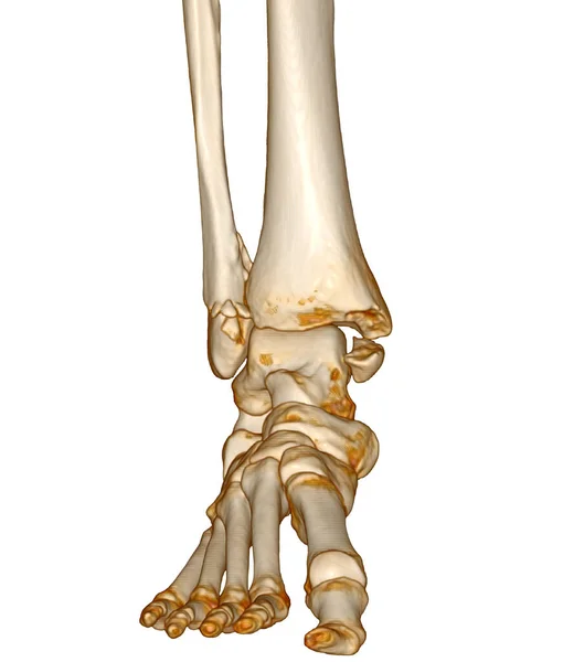 Skan Kostki Stopy Lub Tomografii Komputerowej Stawu Skokowego Stóp 3Drendering — Zdjęcie stockowe