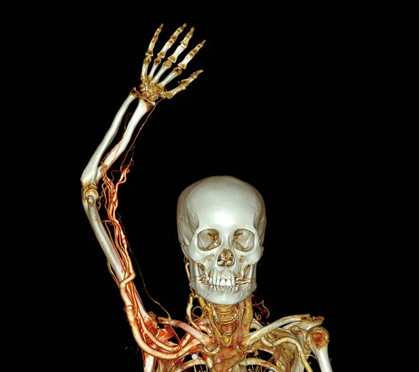 Kari Artériák Kar Felső Végtag Csont Renderelés Szkenner — Stock Fotó