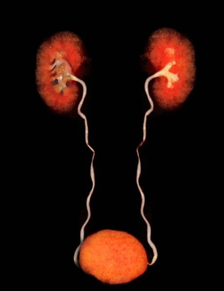 Cta Imagen Renderizado Arteria Renal Que Muestra Ambos Riñones Uréter —  Fotos de Stock