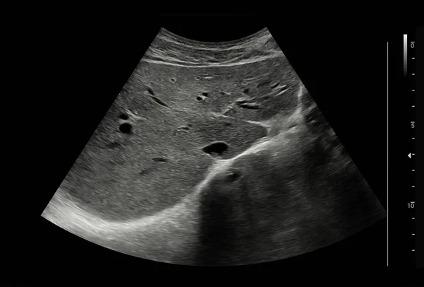 Ultra Som Abdômen Superior Para Diagnóstico Dor Abdominal — Fotografia de Stock