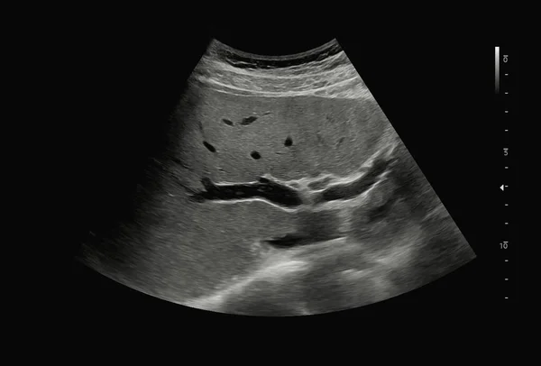 Ultrasonido Abdomen Superior Para Diagnóstico Dolor Abdominal —  Fotos de Stock