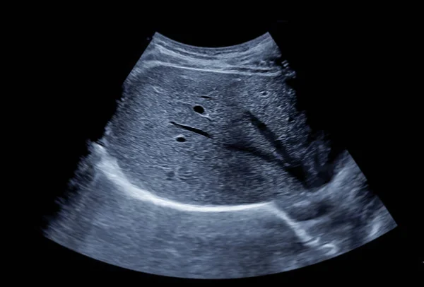 Ultrasonido Abdomen Superior Para Diagnóstico Dolor Abdominal — Foto de Stock