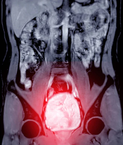 Urografia Por Ressonância Magnética Urografia Estudo Que Usado Predominantemente Para — Fotografia de Stock