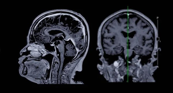 MRI  brain scan Sagittal and coronal view with reference line for detect  Brain  diseases sush as stroke disease, Brain tumors and Infections.