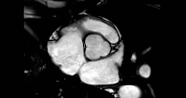 Rmn Cardiac Sau Rmn Cardiac Imagistica Prin Rezonanță Magnetică Inimii — Fotografie, imagine de stoc