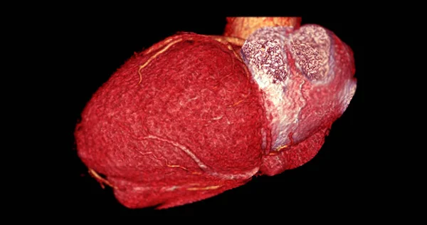 Cardiac Рендеринг Коронарная Артерия Cta Профилактики Заболеваний Коронарной Артерии — стоковое фото