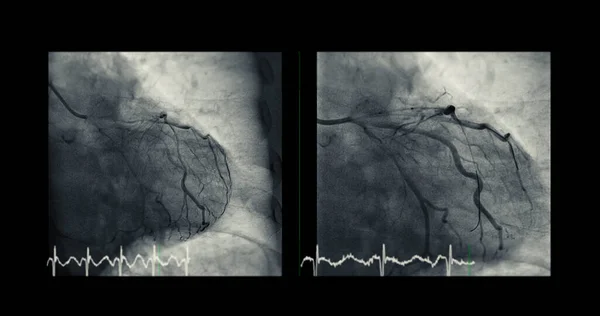 Cateterismo Cardíaco Pode Ajudar Médico Diagnosticar Tratar Problemas Coração Nos — Fotografia de Stock