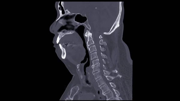 Spine Visão Sagital Coluna Cervical — Fotografia de Stock
