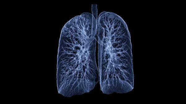 Chest Lung Rendering Image Blue Color Showing Trachea Lung Respiratory — Stock Photo, Image