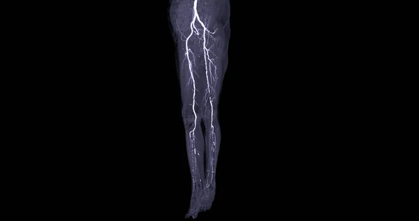 Cta 동맥은 진단을 동맥의 이미지를 — 스톡 사진