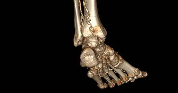 Scanner足部3D扫描诊断足部疾病 — 图库照片