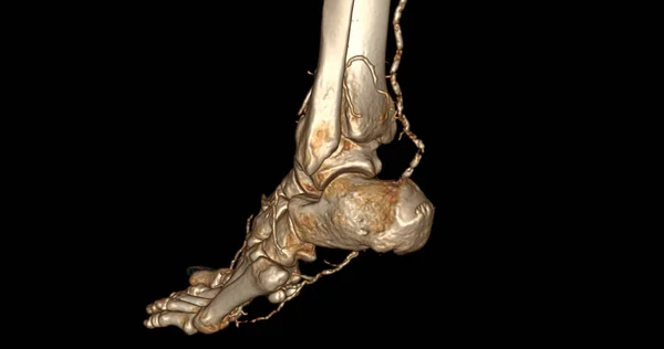 Foot Scan Diagnózis Lábbetegségek Scanner — Stock Fotó