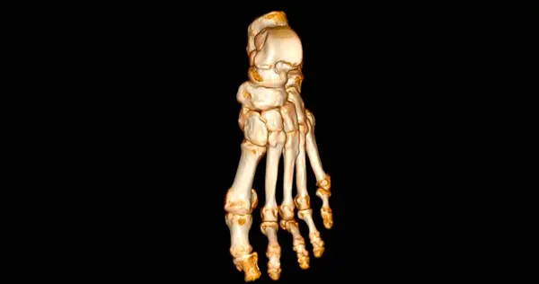 Scannerによる診断足の疾患のためのフット3Dスキャン — ストック写真