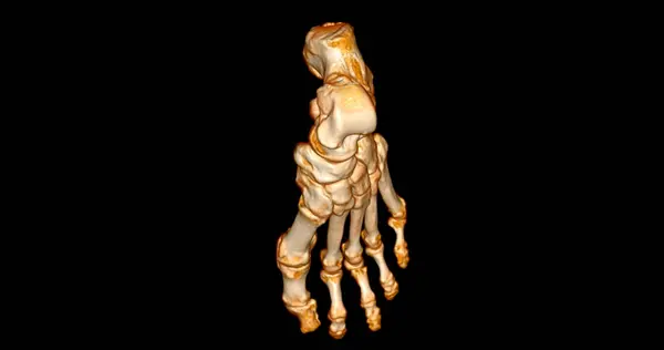 Scanner足部3D扫描诊断足部疾病 — 图库照片