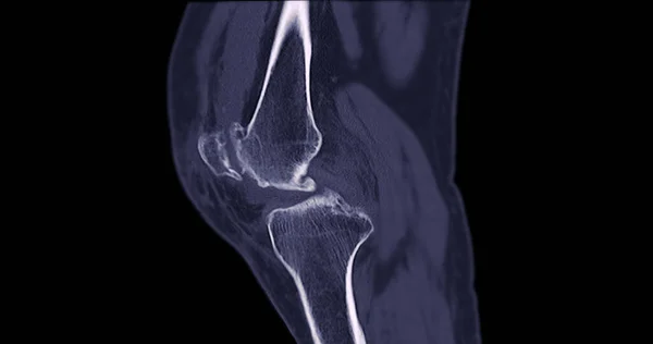 Scan Van Kniegewricht Voor Medische Achtergrond — Stockfoto