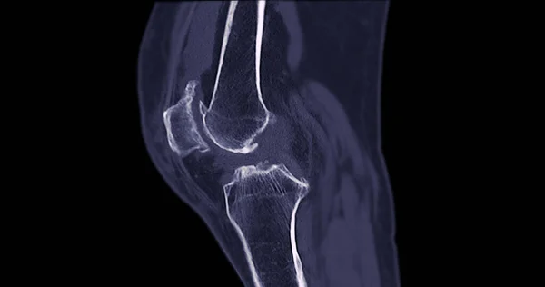 Scan Van Kniegewricht Voor Medische Achtergrond — Stockfoto