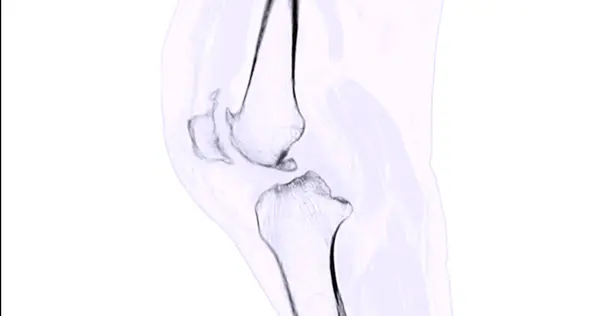 Scan Des Kniegelenks Für Medizinischen Hintergrund — Stockfoto