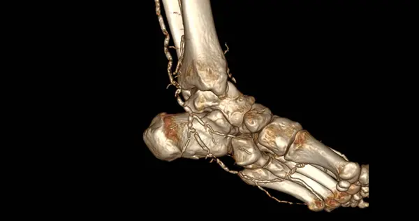 Foot Scan Diagnosis Foot Diseases Scanner Stock Image