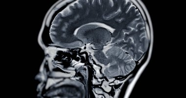 Beyin hastalıklarını tespit etmek için MR taraması. Felç, beyin tümörleri ve enfeksiyonlar gibi..