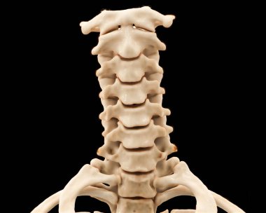 Boyun ya da boyun omurunun CT taraması. Travma durumunda boyun omurgasında kırık teşhisi için 3D görüntüleme..