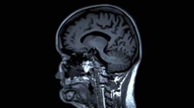 MRI beyin taramaları sagittal görüş, doğru tıbbi değerlendirmeler için beyin anatomisi, fonksiyon ve patoloji hakkında değerli bilgiler sunar..