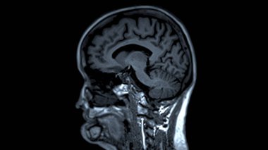 MRI beyin taramaları sagittal görüş, doğru tıbbi değerlendirmeler için beyin anatomisi, fonksiyon ve patoloji hakkında değerli bilgiler sunar..