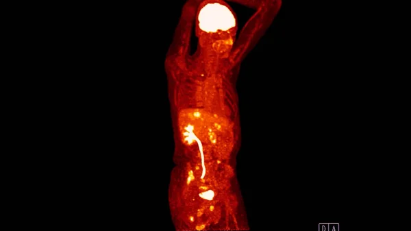 Pet Scan Image Diagnostic Visualization Combining Positron Emission Tomography Pet — Stock Photo, Image