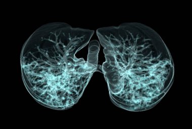 CT Chest or Lung 3d rendering image  showing Trachea and lung in respiratory system.	