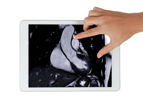 stock image Cardiac MRI images  on Tablet are instrumental in assessing cardiac health, identifying heart abnormalities isolated on white background,.Clipping path.