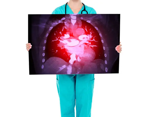 Doktor Görüntüyü Hastaların Teşhisi Anlamasını Sağlamak Için Akciğer Embolisi Kavramını Stok Resim