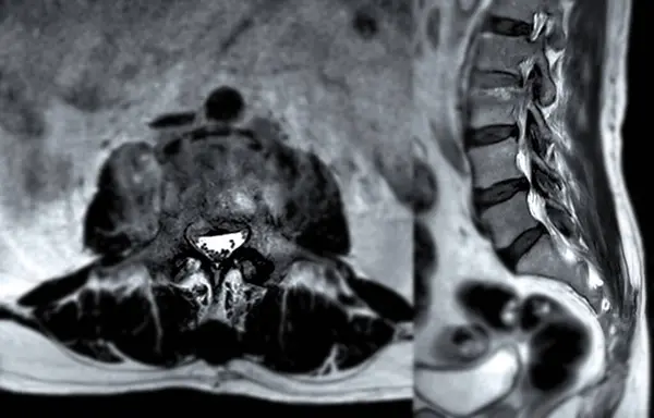 Mri Omurgası Veya Bel Omurgası Axial Sagittal Tekniği Teşhis Için Telifsiz Stok Fotoğraflar