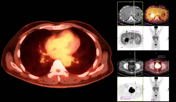 stock image A PET CT scan image shows comprehensive views of organs and tissues.