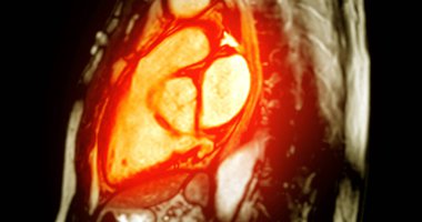 MRI kalp stres testi, kontrollü koşullar altında detaylı kalp fonksiyonlarını gösteriyor, erken teşhis ve yüksek çözünürlüklü görüntüleme stres sırasında kalp performansını yakalıyor.