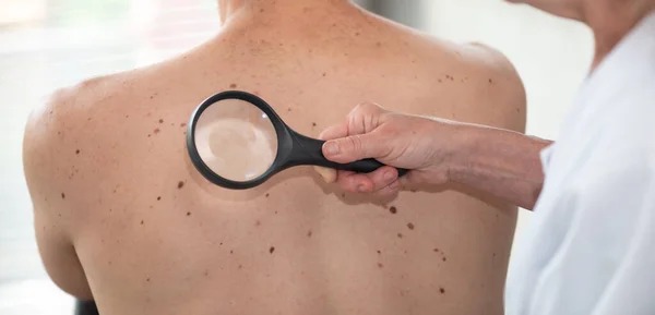 Dermatoloog Onderzoekt Huid Van Patiënt Terug — Stockfoto