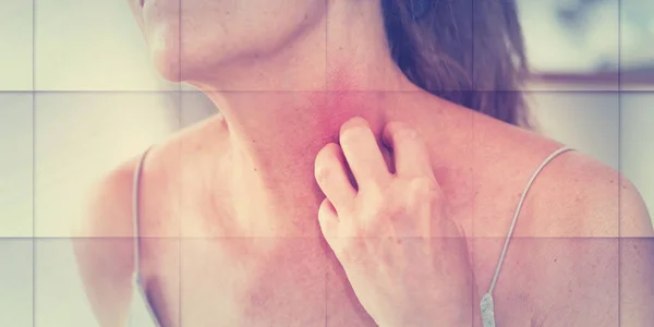 Wanita Yang Gatal Dan Menggaruk Lehernya Gejala Alergi Pola Geometris — Stok Foto