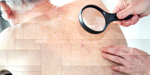 Dermatolog Vyšetřuje Kůži Pacienta Zádech Geometrický Vzorec — Stock fotografie