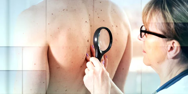 Dermatologe Untersucht Die Haut Auf Dem Rücken Eines Patienten Geometrisches — Stockfoto