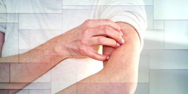 女人发痒 手臂挠痒 过敏症状 几何图案 — 图库照片