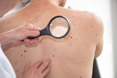 Dermatolog hastanın cildini inceliyor.